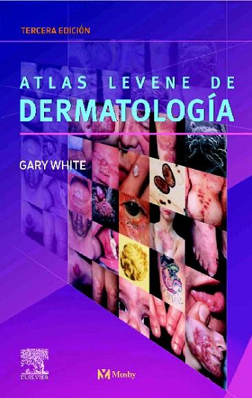 ATLAS LEVENE DE DERMATOLOGÍA | 9788481747652 | Llibreria L'Illa - Llibreria Online de Mollet - Comprar llibres online